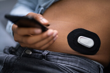 Man Testing Glucose Level With Continuous Glucose Monitor