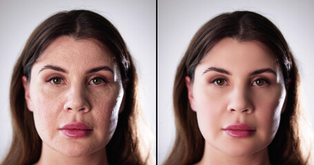 Before After Young Girl Face Wrinkle