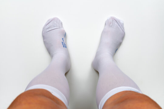 A person wearing a pair of compression stockings after surgery to prevent blood clots and deep vein thrombosis.