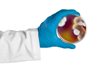 Hand in glove holding Petri dish with bacteria