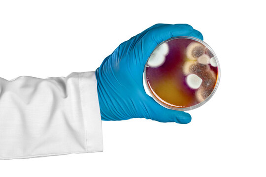 Hand In Glove Holding Petri Dish With Bacteria