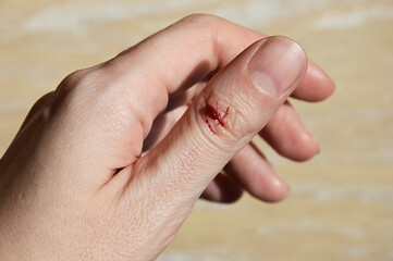 a wound on his arm, blood on his finger from a knife cut. female hands. background for the design.