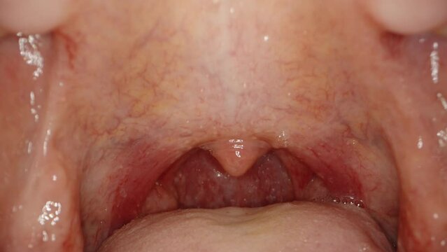 Examination of the oral cavity of a man. Macro probe inside the mouth.