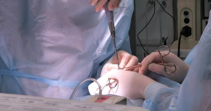 A veterinarian tightens a bolt on a plate placed on a pet's broken paw in the operating room. A surgeon fixes broken bones on a pet's paw with a titanium plate. Osteosynthesis in veterinary medicine.