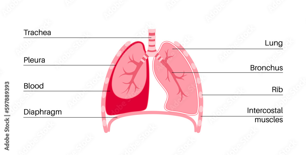 Canvas Prints Hemothorax medical poster