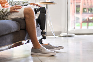 Man amputee with prosthetic leg disability on above knee transfemoral leg prosthesis artificial device sitting on sofa, close up. People with amputation disabilities everyday life concept.