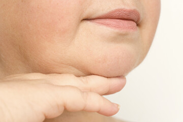 Obraz premium close up part face mature woman 55 years old, human fat neck, side view, double saggy chin, deep wrinkles, age-related skin changes, cosmetic anti-aging procedures, skin tightening