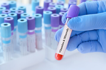 Doctor holding a test blood sample tube with Vitamins and Minerals test on the background of medical test tubes with analyzes.