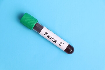 Blood type B Rh positive test, blood sample to analyze in the laboratory