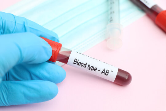 Blood type AB Rh negative test, blood sample to analyze in the laboratory