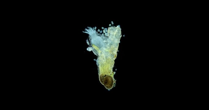 Freshwater bryozoans under microscope, Class Phylactolaemata, Order Plumatellida. Filter feeders. Similar to worms in Sabellida family