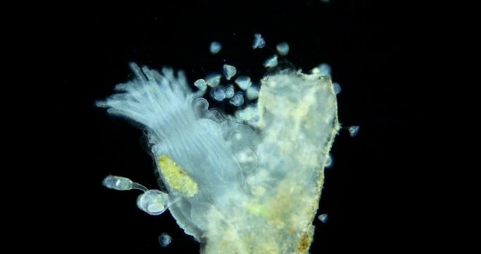 Freshwater bryozoans under microscope, Class Phylactolaemata, Order Plumatellida. Filter feeders. Similar to worms in Sabellida family