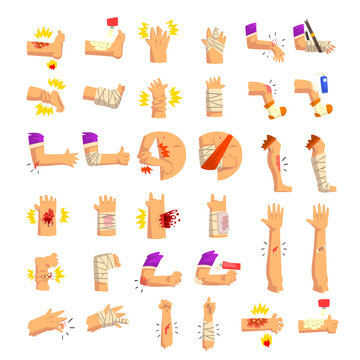 Bandaged injured human body parts set cartoon vector illustration