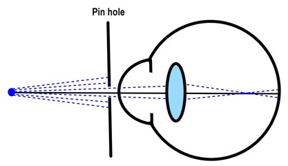 the refraction of light and pin hole test