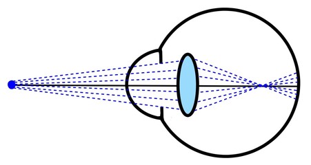 the refraction of light and pin hole test