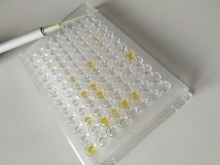 Enzyme-linked immunosorbent assay (ELISA), Immunology testing method in laboratory