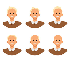 Alopecia stages and hair loss process, flat vector illustration isolated on white background.