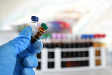 Lab tech holding LCMS testing vials in a laboratory for drug testing