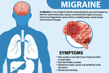 Informative poster of Migraine