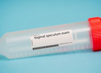 Vaginal speculum exam