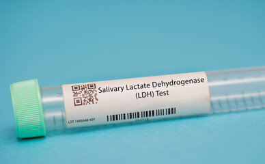Salivary Lactate Dehydrogenase (LDH) Test