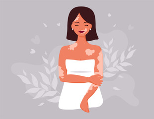World Vitiligo Day. Another kind of beauty. Love yourself, accept your body. Body positive and self acceptance. Vector illustration