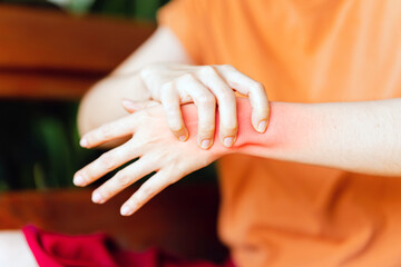 Woman with wrist sprain and wrist pain due to inflammation. Health care concept.