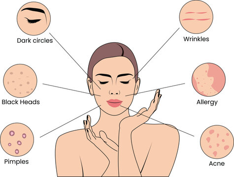 Vector Art Depicting Various Skin Issues, Vector-Based Guide to Skin Problems, Illustrated Vector Guide to Skin Conditions