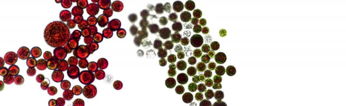 Haematococcus pluvialis green and cyst algae under microscopic view - haematocyst, active and resting cells, strong antioxidant astaxanthin