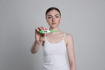 Woman with rash holding thermometer on light grey background. Monkeypox virus