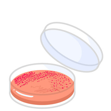 The isolation of bacteria on agar plates. Lactose fermenters turn red or pink and nonfermenters do not change color on MacConkey agar. Petri dish illustration.