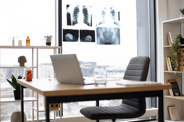 Focus on body x-ray scans being placed on panoramic window glass in modern consulting room with...