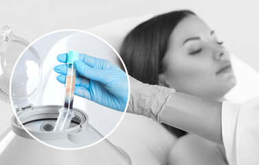 Cosmetologist does prp therapy on the face of a beautiful woman in a beauty salon. There is in...