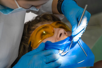 Patient with a blue cofferdam in a dental clinic, a dentist in latex gloves examines a tooth with a mirror, a visit to the dentist.