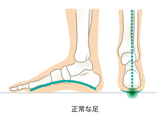 正常なアーチの足の側面と後ろ面