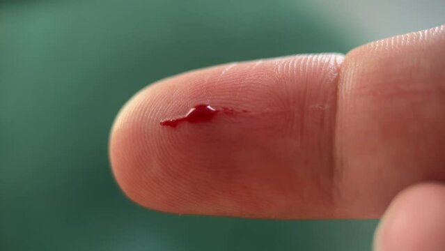 Cut On The Skin Of The Finger On The Green Background