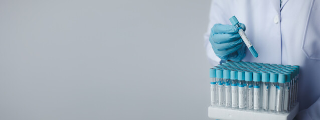 Lab assistant, a medical scientist, a chemistry researcher holds a glass tube through the blood sample, does a chemical experiment and examines a patient's blood sample. Medicine and research concept.