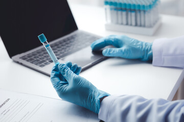Lab assistant, a medical scientist, a chemistry researcher holds a glass tube through the blood sample, does a chemical experiment and examines a patient's blood sample. Medicine and research concept.
