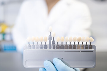 Close up of shade guide to check veneer of tooth crown in a dental laboratory.  Dental technician...