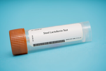 Stool Lactoferrin Test