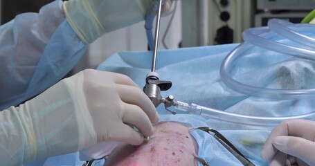 The surgeon inserts an endoscopic instrument into a port placed in the pet's abdomen. In surgery, a...