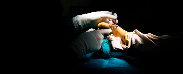 Hand of doctor or surgeon did foot surgery inside an operating room in the hospital.People in green gown used medical tools to suture the surgical wound.Foot and toe surgery of bunion.Light effect. - obrazy, fototapety, plakaty