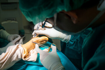 Hand of doctor or surgeon did foot surgery inside an operating room in the hospital.People in green...
