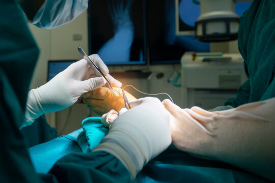 Hand of doctor or surgeon did foot surgery inside an operating room in the hospital.People in green gown used medical tools to suture the surgical wound.Foot and toe surgery of bunion.Light effect.