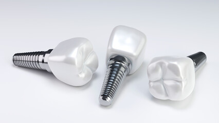 Tooth and dental implant for stomatology set, Implants surgery concept, 3D rendering