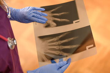 Zdjęcie rentgenowskie 