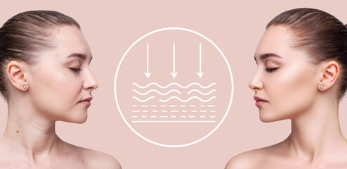 Woman before and after lifting skin. Infographic shows deep penetration of remedy in skin.