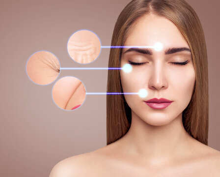 Circles shows before and after lifting cosmetic procedure.
