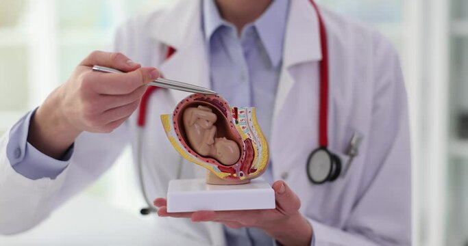 Gynecologist shows fetus in uterus of anatomical model of human organ. Preparing for pregnancy