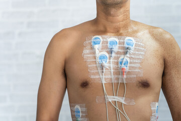 Man wearing 24 hrs electrocardiogram monitor device on his chest, Electrodes rhythm Holter...